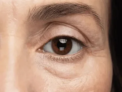 Anti Aging Wrinkles